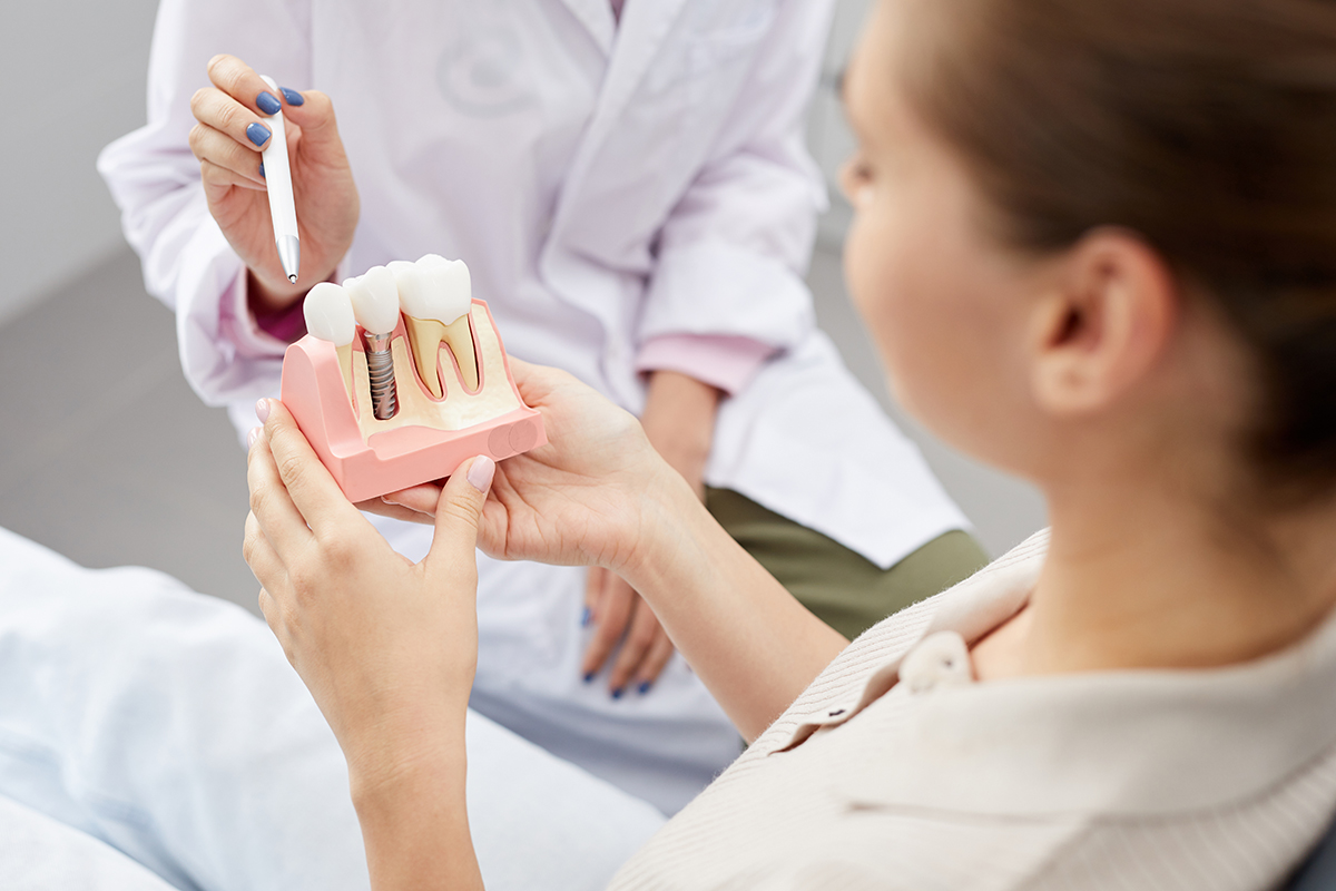 Advancements in Dental Implants Holistic Choices