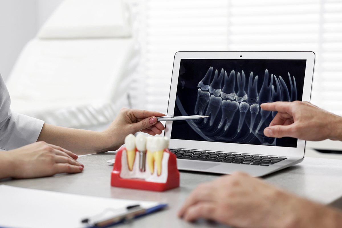 Exploring Bone Grafting Materials for Dental Implants